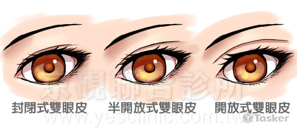 醫美診所 網頁用-雙眼皮風格