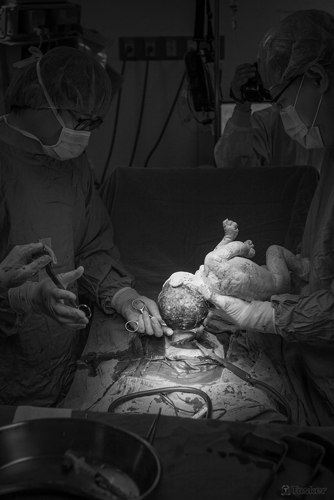 入手術室內已經院方同意,剖腹產因感染問題一般不予外人進入唷