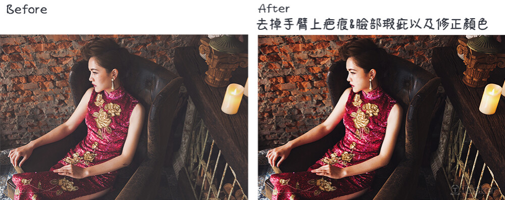 將手臂上疤痕去除&臉部瑕疵及修色