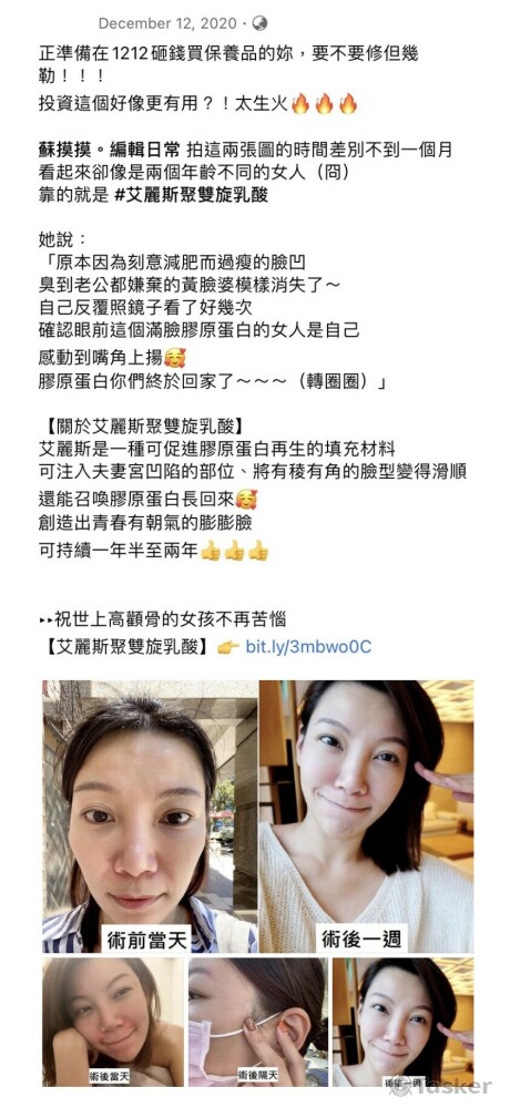 醫美品牌社群貼文_KOL合作文