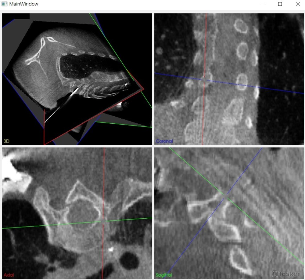 經過自由調整重切面，成為醫師易於辨識的角度視圖