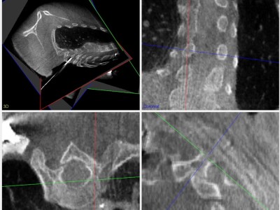 python醫學影像自由四視圖
